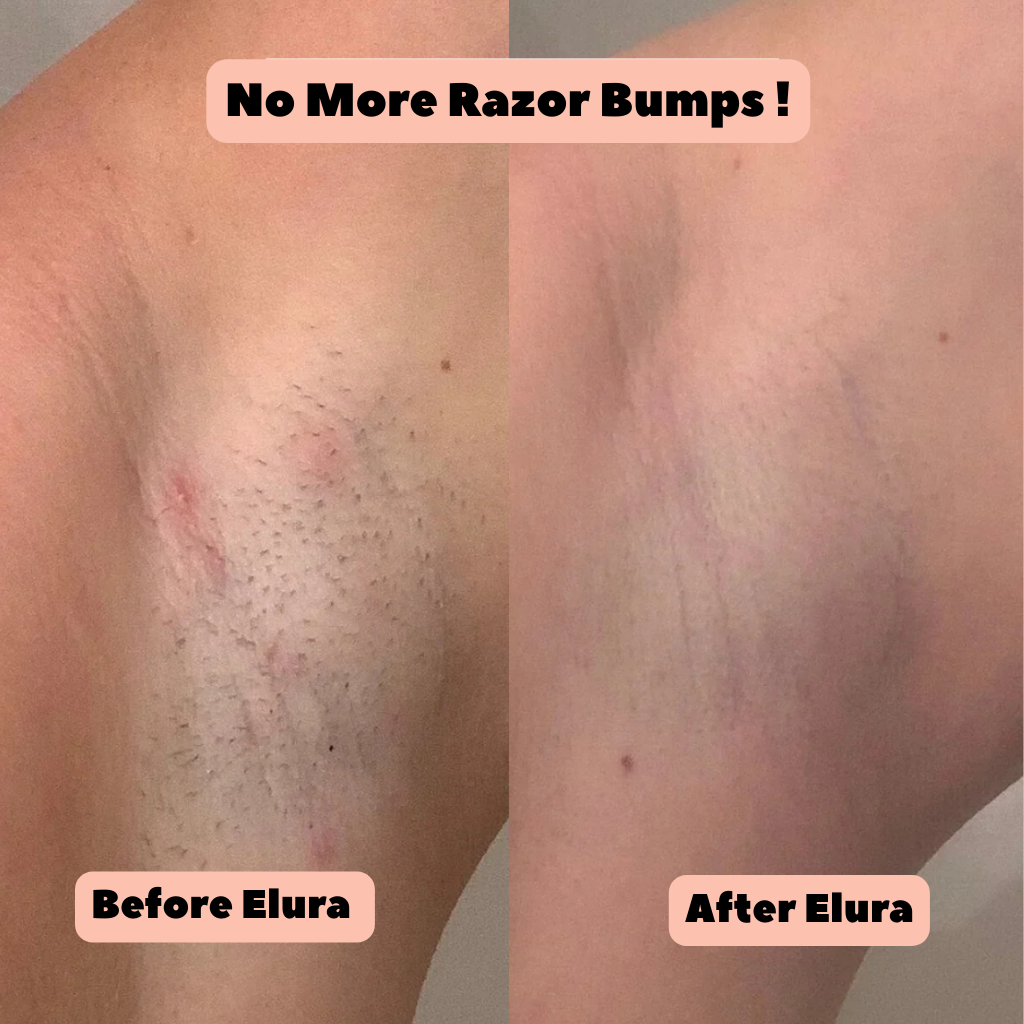 Elura™ 2-In-1 Womens Body Trimmer