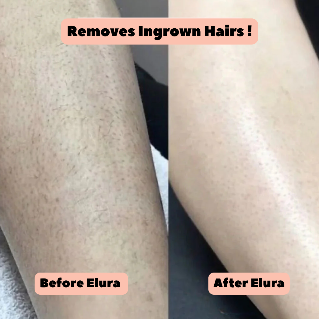 Elura™ 2-In-1 Womens Body Trimmer