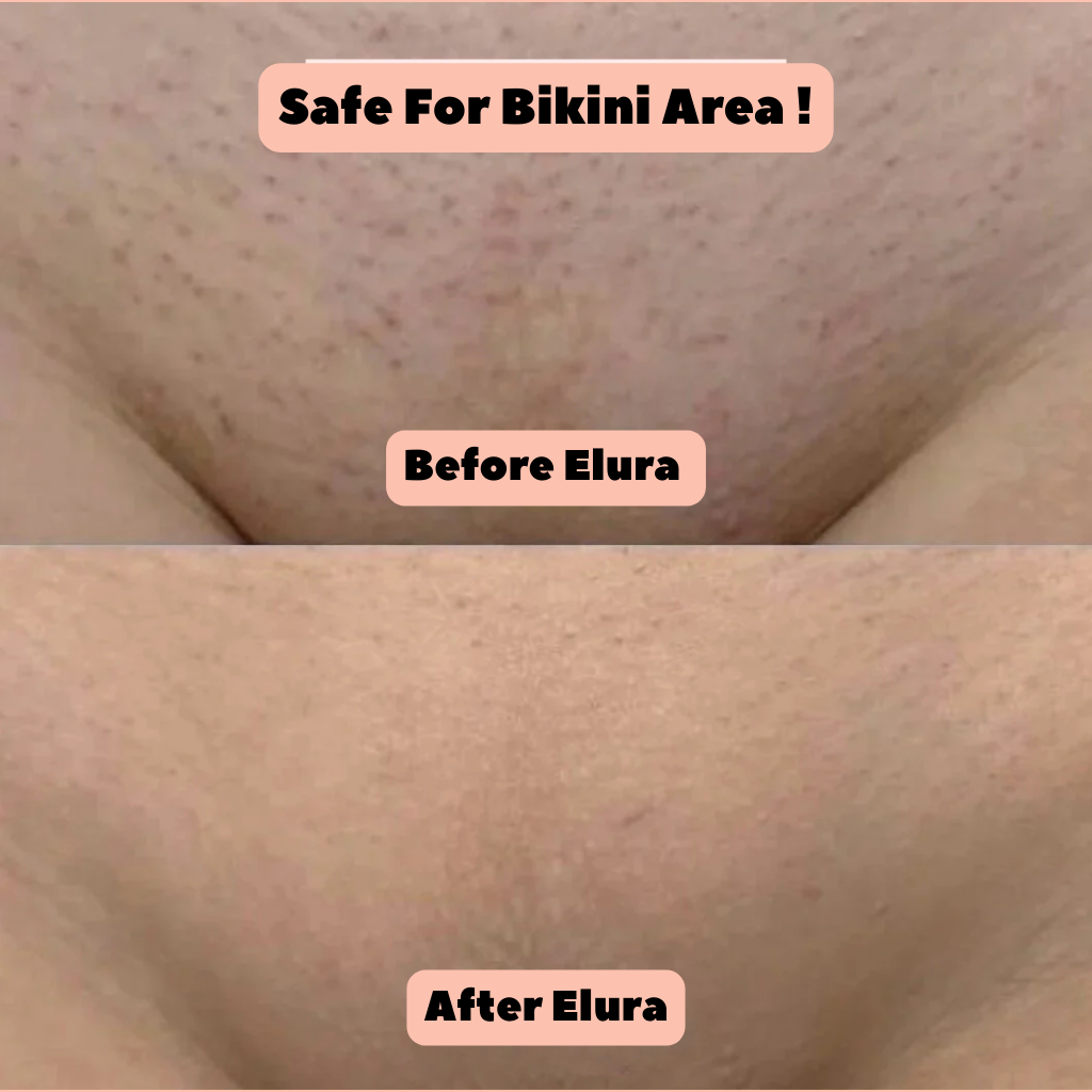 Elura™ 2-In-1 Womens Body Trimmer